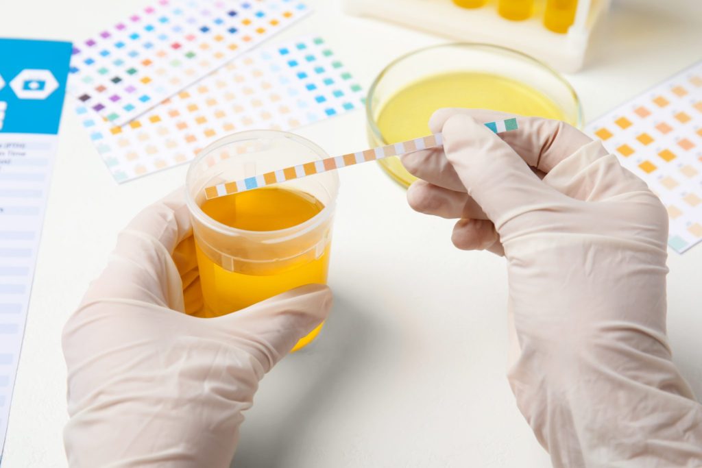 Does Cbd Show Up On Drug Tests
